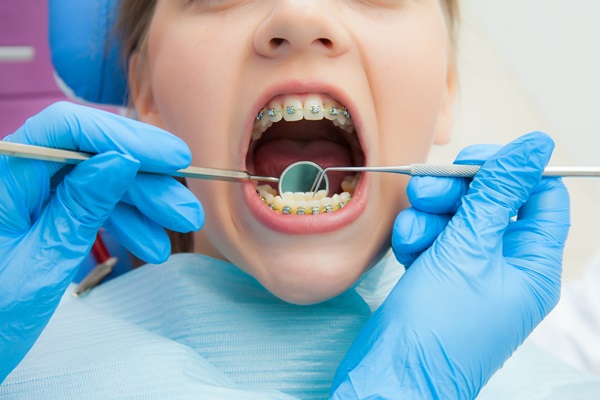 The Role Of A Braces Specialist In Treating Unique Orthodontic Challenges